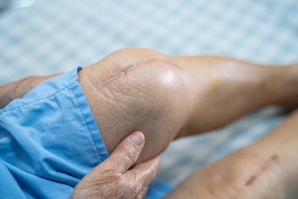 best doctor for knee replacement in vashi